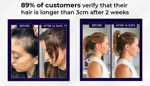 🌿AKTION ZUM LETZTEN TAG – 50 % RABATT🌿 HZA™ Natürliches Haarwuchsspray