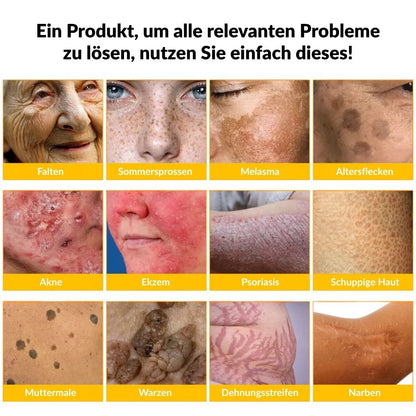 ✨✨Ourlyard® Bee Venom Skin Restoration Cream - 🔥Limited Time 80% OFF🔥