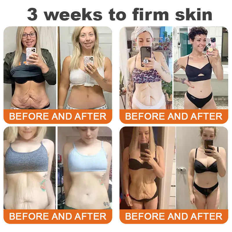 🐝💖Flysmus™ Botox Bee Venom Firming Serum Stick – (Hergestellt und versendet in Germany) – LETZTER TAG 70 % RABATT