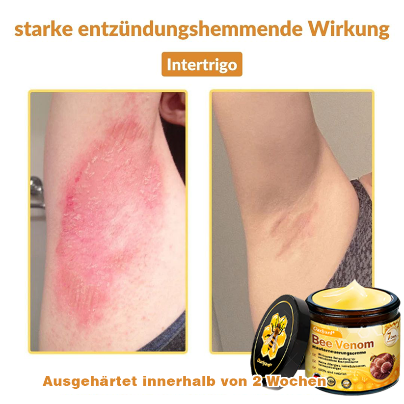 ✨✨Ourlyard® Bee Venom Skin Restoration Cream - 🔥Limited Time 80% OFF🔥