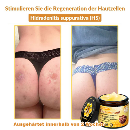 ✨✨Ourlyard® Bee Venom Skin Restoration Cream - 🔥Limited Time 80% OFF🔥