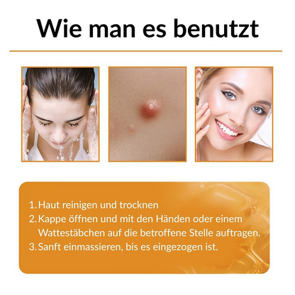 ✨✨Ourlyard® Bee Venom Skin Restoration Cream - 🔥Limited Time 80% OFF🔥