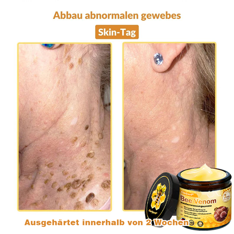 ✨✨Ourlyard® Bee Venom Skin Restoration Cream - 🔥Limited Time 80% OFF🔥