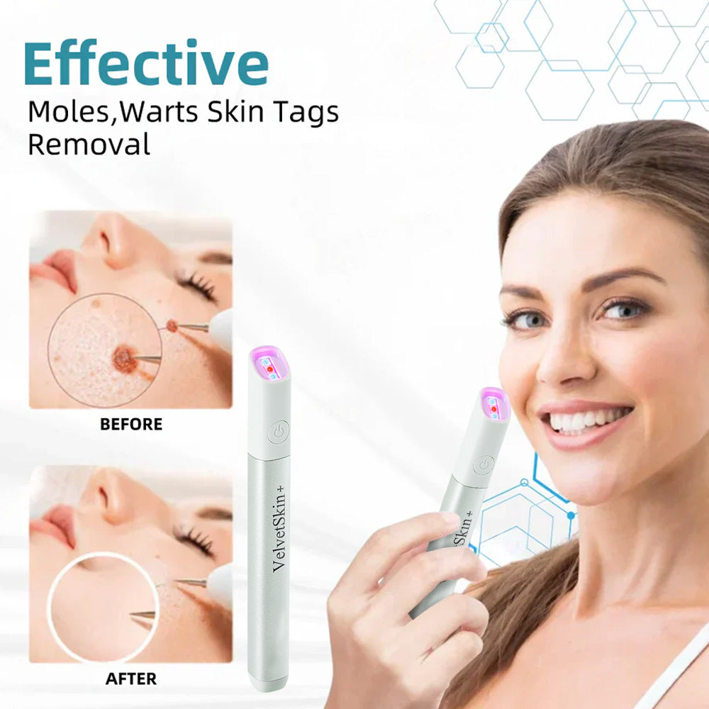 ☂DedMuller® VelvetSkin+Series ⚔️All-in-One Laser Eraser Pen🖊️ (🔬Powered by CO₂ laser technology – effectively removes moles, warts, skin tags, pigmentation spots, and other skin imperfections)