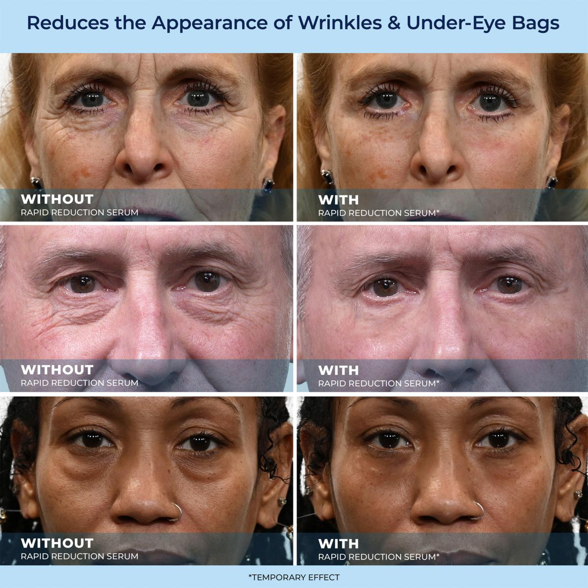 🔥Letzter Tagesverkauf: 49 % Rabatt auf LBMLBM-HOYGI™ 60-Sekunden-Anti-Aging-Serum gegen Falten, Tränensäcke und Augenringe